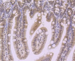 Invitrogen NOD3 Polyclonal Antibody 100 &mu;L; Unconjugated:Antibodies,