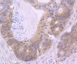 Invitrogen NOD3 Polyclonal Antibody 100 &mu;L; Unconjugated:Antibodies,