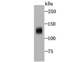 Invitrogen NOD3 Polyclonal Antibody 100 &mu;L; Unconjugated:Antibodies,