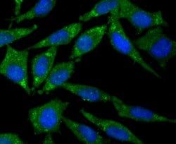 Thermo Scientific CD21 Polyclonal Antibody:Antibodies, Polyclonal