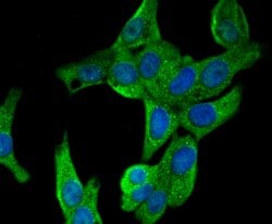 Thermo Scientific CD21 Polyclonal Antibody:Antibodies, Polyclonal