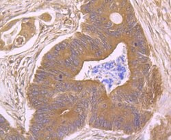 Thermo Scientific CD21 Polyclonal Antibody:Antibodies, Polyclonal