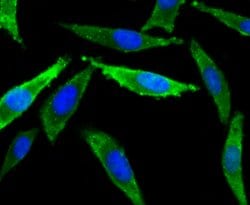 Invitrogen SCN9A Polyclonal Antibody:Antibodies:Primary Antibodies