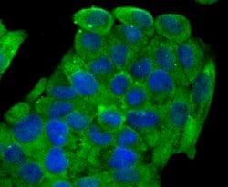 Invitrogen SCN9A Polyclonal Antibody:Antibodies:Primary Antibodies