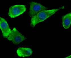 Invitrogen SCN9A Polyclonal Antibody:Antibodies:Primary Antibodies