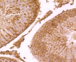 Invitrogen SCN9A Polyclonal Antibody:Antibodies:Primary Antibodies