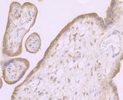 Invitrogen SCN9A Polyclonal Antibody:Antibodies:Primary Antibodies