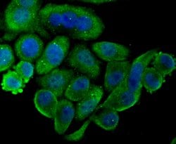 Invitrogen MSI2 Polyclonal Antibody 100 &mu;L | Buy Online | Invitrogen&trade; | Fisher Scientific