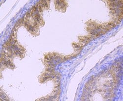 Invitrogen MSI2 Polyclonal Antibody 100 &mu;L | Buy Online | Invitrogen&trade; | Fisher Scientific