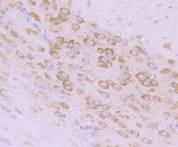 Invitrogen MSI2 Polyclonal Antibody 100 &mu;L | Buy Online | Invitrogen&trade; | Fisher Scientific