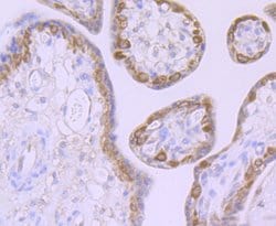 Invitrogen MSI2 Polyclonal Antibody 100 &mu;L | Buy Online | Invitrogen&trade; | Fisher Scientific