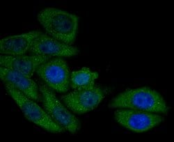 Invitrogen AMACR Polyclonal Antibody 100 μL; Unconjugated:Antibodies,