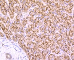 Invitrogen AMACR Polyclonal Antibody 100 μL; Unconjugated:Antibodies,