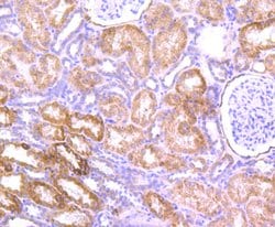 Invitrogen AMACR Polyclonal Antibody 100 μL; Unconjugated:Antibodies,