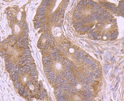 Invitrogen AMACR Polyclonal Antibody 100 μL; Unconjugated:Antibodies,