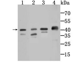 Invitrogen AMACR Polyclonal Antibody 100 μL; Unconjugated:Antibodies,