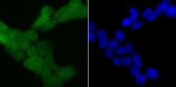 Invitrogen 4EBP1 Polyclonal Antibody 100 μL; Unconjugated:Antibodies,