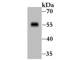 Invitrogen CD127 Polyclonal Antibody 100 &mu;L; Unconjugated:Antibodies,