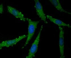 Invitrogen NOD3 Polyclonal Antibody:Antibodies:Primary Antibodies