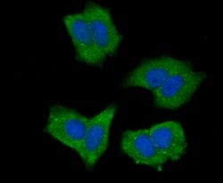 Invitrogen NOD3 Polyclonal Antibody:Antibodies:Primary Antibodies