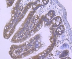 Invitrogen NOD3 Polyclonal Antibody:Antibodies:Primary Antibodies