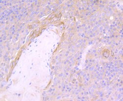 Invitrogen NOD3 Polyclonal Antibody:Antibodies:Primary Antibodies