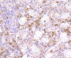 Invitrogen NOD3 Polyclonal Antibody:Antibodies:Primary Antibodies