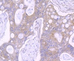 Invitrogen NOD3 Polyclonal Antibody:Antibodies:Primary Antibodies