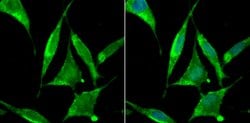 Invitrogen ZBTB48 Polyclonal Antibody 100 &mu;L; Unconjugated:Antibodies,