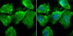 Invitrogen ZBTB48 Polyclonal Antibody 100 &mu;L; Unconjugated:Antibodies,