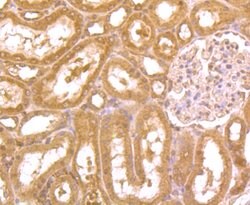 Invitrogen ZBTB48 Polyclonal Antibody 100 &mu;L; Unconjugated:Antibodies,