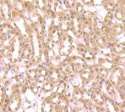 Invitrogen ZBTB48 Polyclonal Antibody 100 &mu;L; Unconjugated:Antibodies,