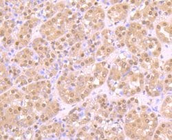 Invitrogen ZBTB48 Polyclonal Antibody 100 &mu;L; Unconjugated:Antibodies,