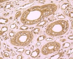 Invitrogen ZBTB48 Polyclonal Antibody 100 &mu;L; Unconjugated:Antibodies,