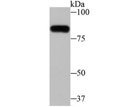 Invitrogen ZBTB48 Polyclonal Antibody 100 &mu;L; Unconjugated:Antibodies,