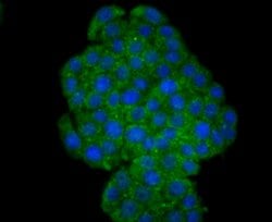Invitrogen TrkA Polyclonal Antibody 100 μL; Unconjugated:Antibodies,
