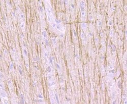 Invitrogen TrkA Polyclonal Antibody 100 μL; Unconjugated:Antibodies,