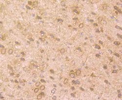 Invitrogen TrkA Polyclonal Antibody 100 μL; Unconjugated:Antibodies,