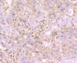 Invitrogen TrkA Polyclonal Antibody 100 μL; Unconjugated:Antibodies,