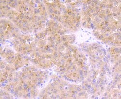 Invitrogen TrkA Polyclonal Antibody 100 μL; Unconjugated:Antibodies,