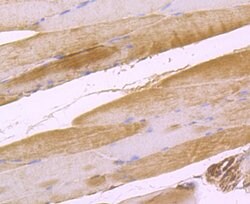 Invitrogen IL-17A Polyclonal Antibody 100 μL; Unconjugated:Antibodies,