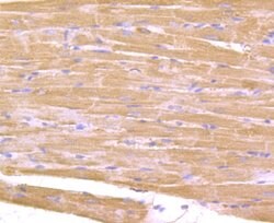 Invitrogen IL-17A Polyclonal Antibody 100 μL; Unconjugated:Antibodies,