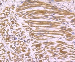 Invitrogen IL-17A Polyclonal Antibody 100 μL; Unconjugated:Antibodies,