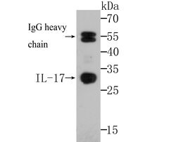 Invitrogen IL-17A Polyclonal Antibody 100 μL; Unconjugated:Antibodies,