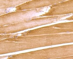 Thermo Scientific DOCK4 Polyclonal Antibody:Antibodies, Polyclonal