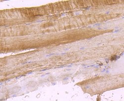 Thermo Scientific DOCK4 Polyclonal Antibody:Antibodies, Polyclonal