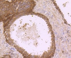 Thermo Scientific DOCK4 Polyclonal Antibody:Antibodies, Polyclonal