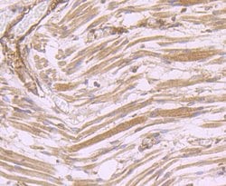 Thermo Scientific DOCK4 Polyclonal Antibody:Antibodies, Polyclonal