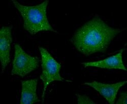 Invitrogen LC3A/LC3B Polyclonal Antibody 100 &mu;L; Unconjugated:Antibodies,