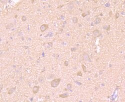 Invitrogen LC3A/LC3B Polyclonal Antibody 100 &mu;L; Unconjugated:Antibodies,